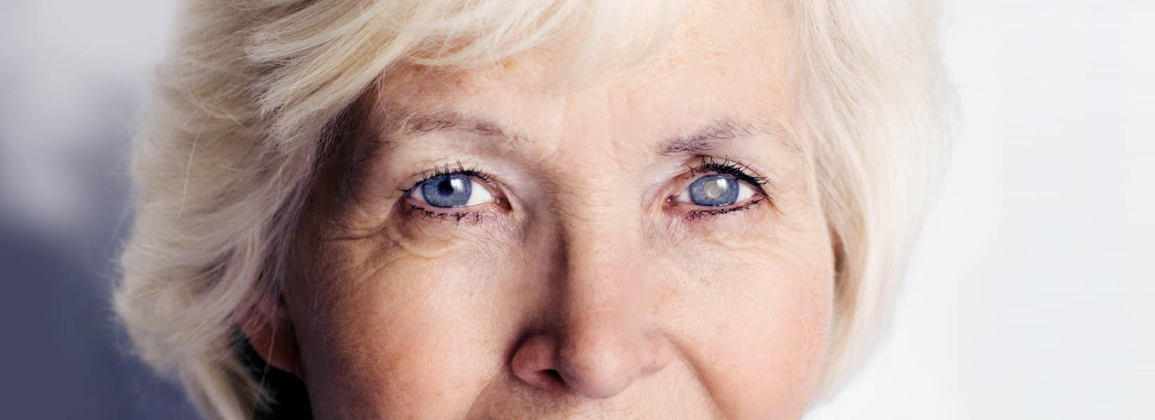 Cataract Surgery in Northwest El Paso
